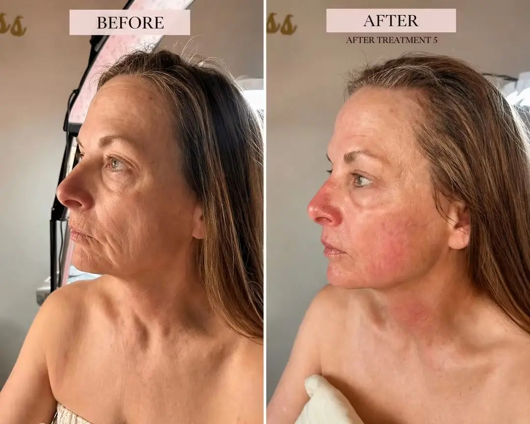 The Clinical Verdict on Photobiomodulation: How 7 LED Wavelengths Transform the Skin Structure