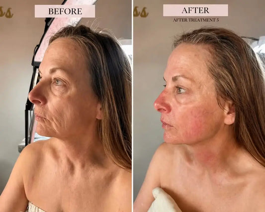 The Clinical Verdict on Photobiomodulation: How 7 LED Wavelengths Transform the Skin Structure