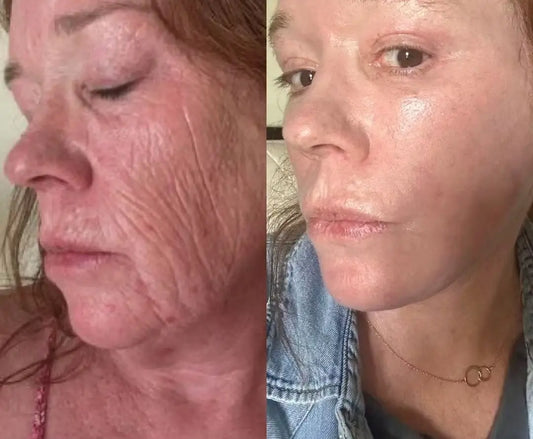 Why Your $80 Serum Stopped Working After 40