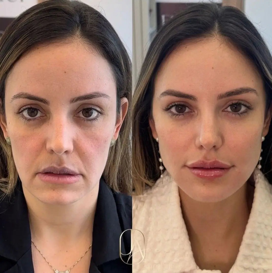 Before and after makeup comparison of a woman's face.