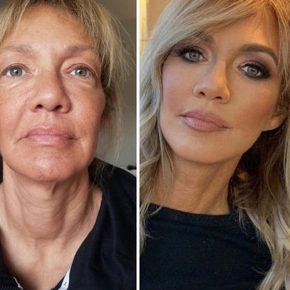 Before and after comparison of a woman's face with 'Vertical Restore' text.