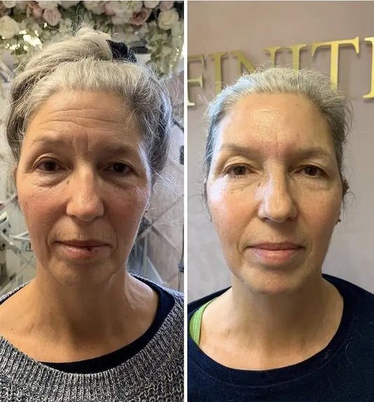 Side-by-side comparison of a woman with and without makeup against different backgrounds.