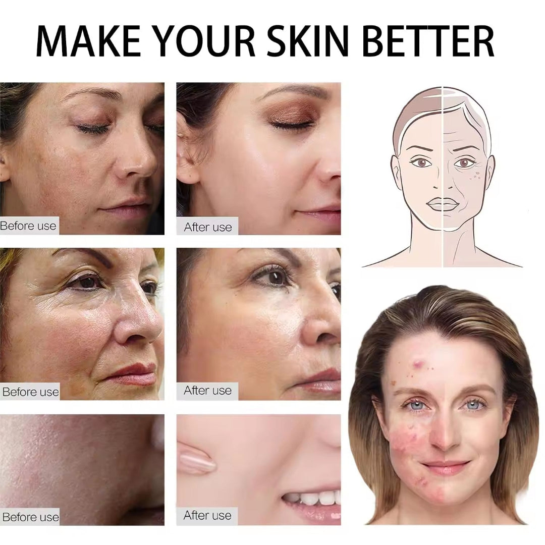 Before and after effects of a skincare product on various skin conditions.