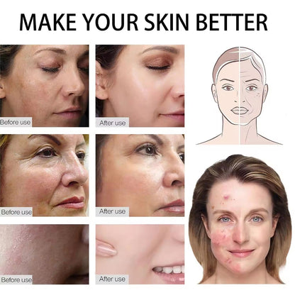 Before and after effects of a skincare product on various skin conditions.