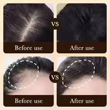 Velura Hair Growth Restoration System