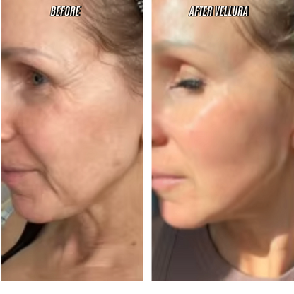 Before and after comparison of a woman's face with Vellura product application.