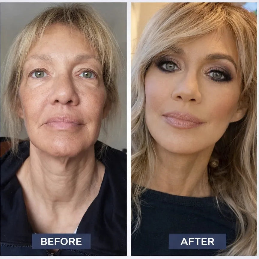 Professional Skin Renewal System at Home + 🎁 FREE LED Lifting Device ($79 Value) — Limited Stock | Vellura skincare device.