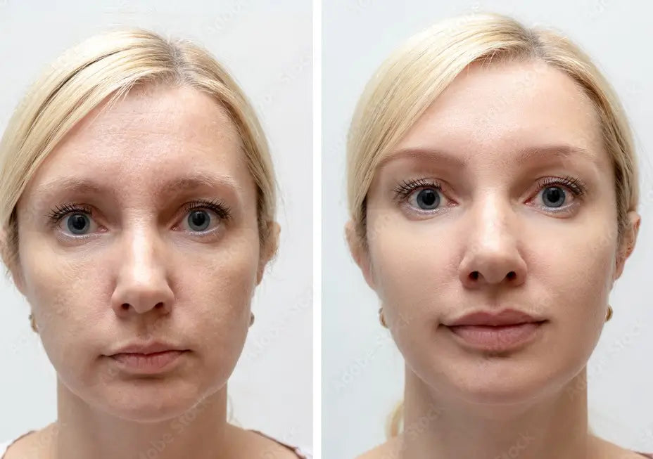 Before and after comparison of a woman's face with blonde hair on a white background