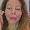Best Microinfusion System Demonstartion Women Before After