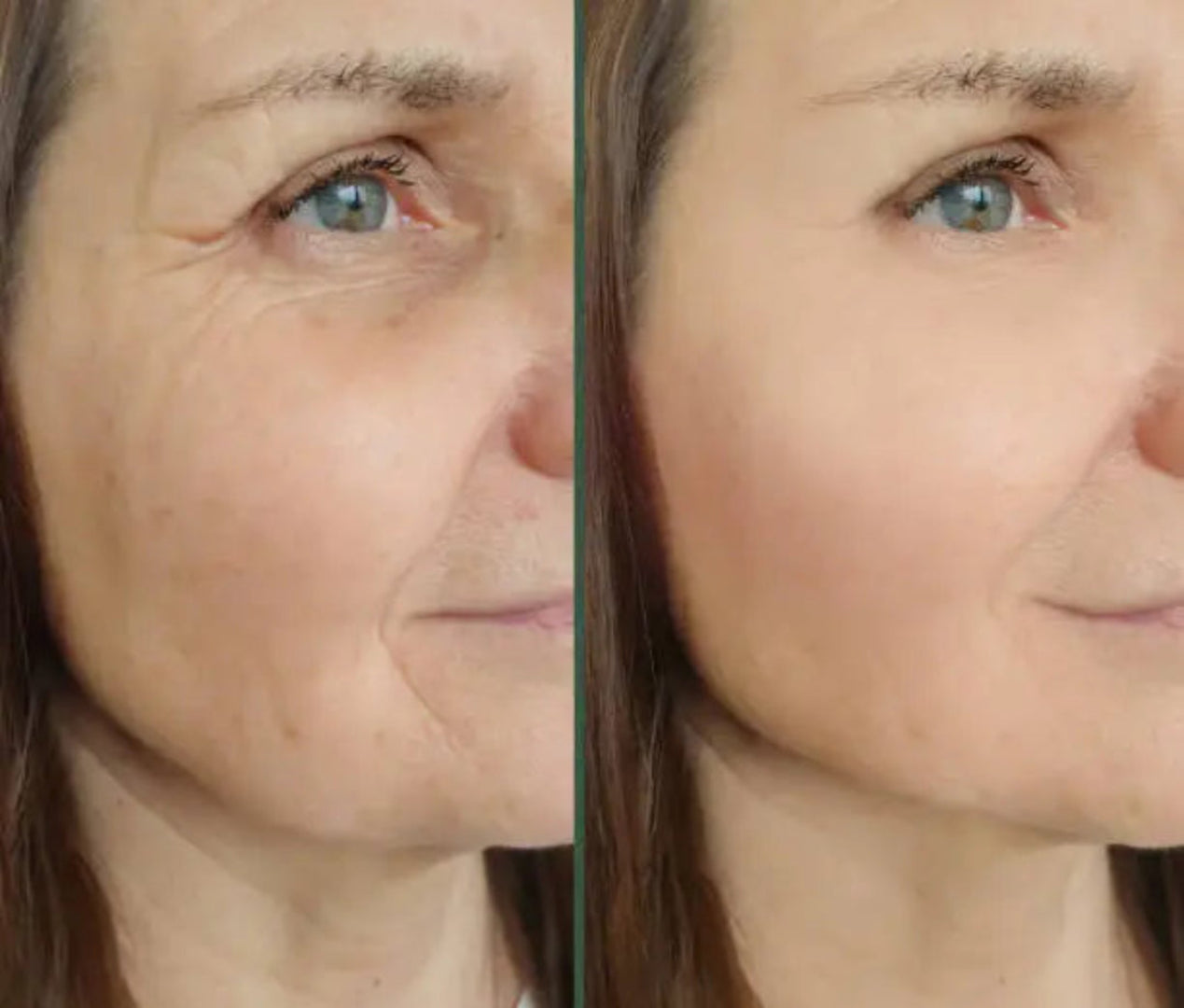 Before and after comparison of a woman's face with visible skin texture differences.